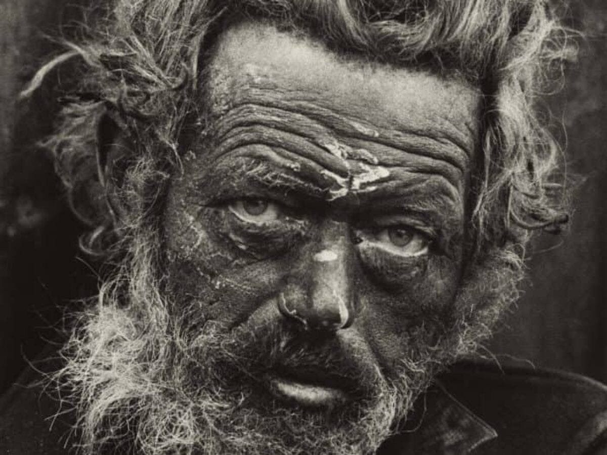 Homeless Irishman